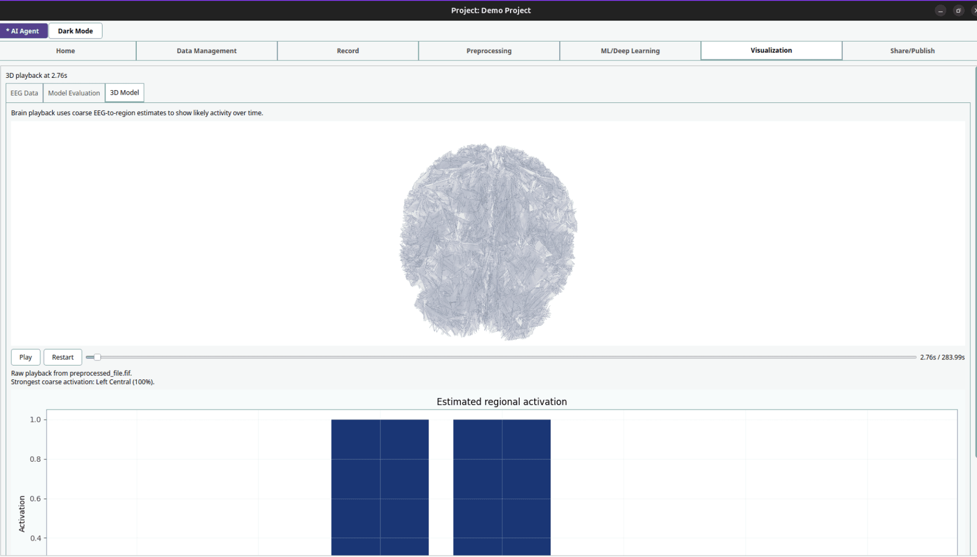 PyBCI Visualization screen showing 3D brain playback and estimated regional activation.